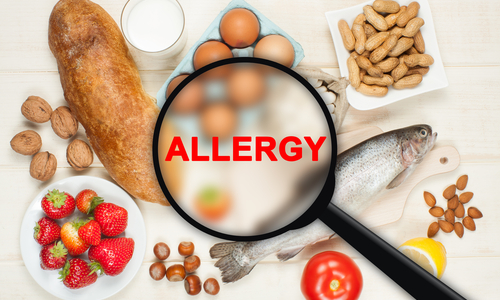 Level 3 Management of Food Allergies Awareness on Campus